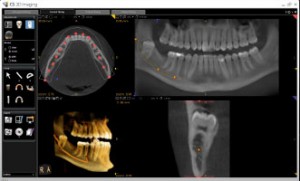 Carestream_3D-CS-training