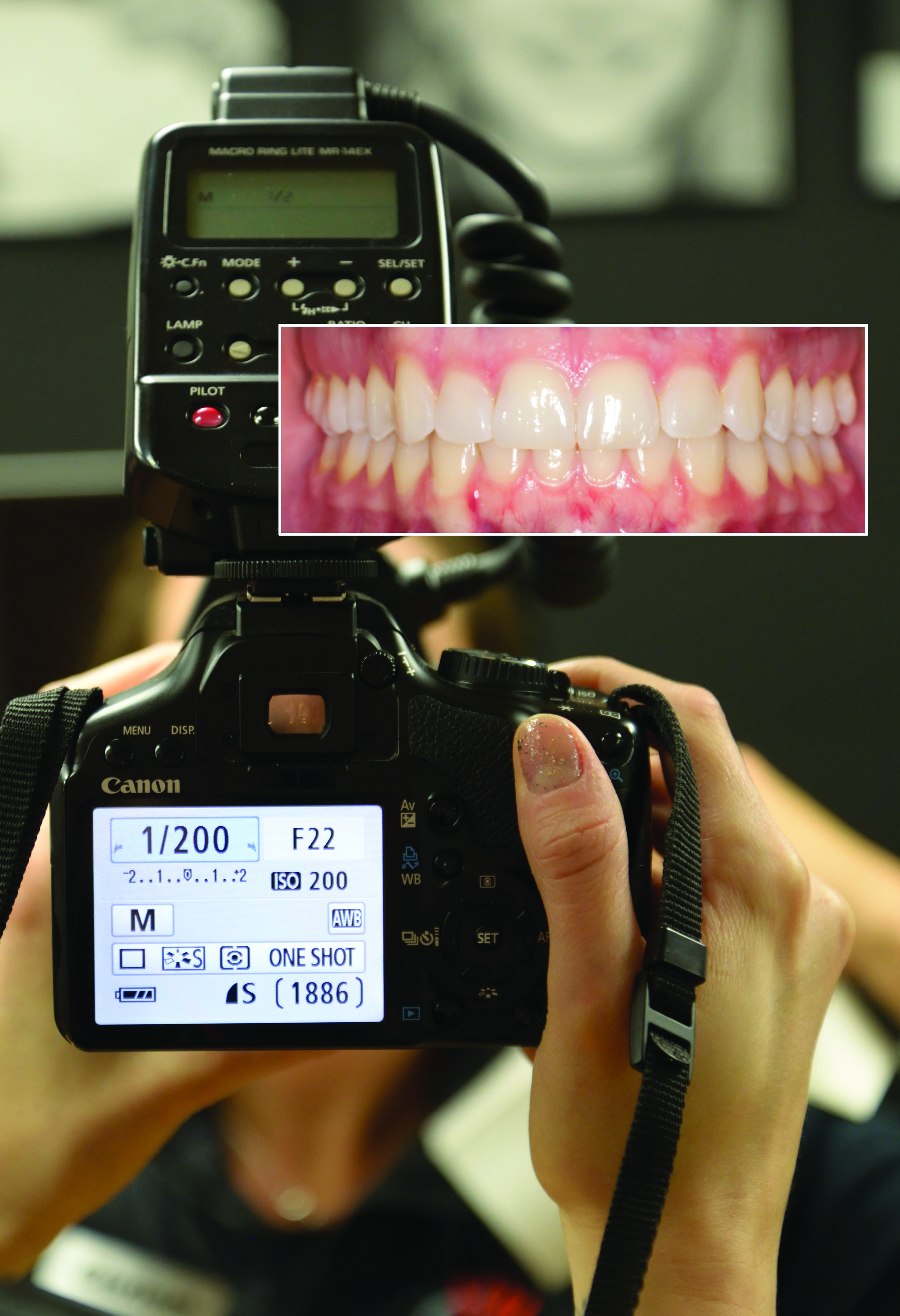 How to start with Dental Photography? Here comes the cheapest EOS from Canon !