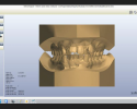 DDS Lab_OrthoVault