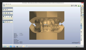 DDS Lab_OrthoVault