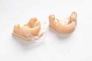 Resin models, printed with the Stratasys Objet30, are used to fabricate appliances, clear aligners, and retainers.